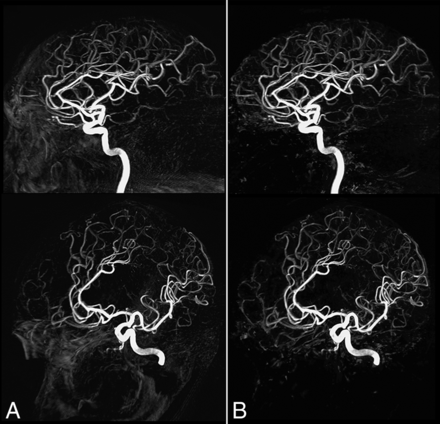 Fig 4.