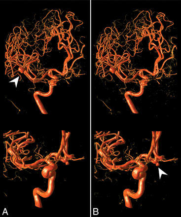Fig 5.