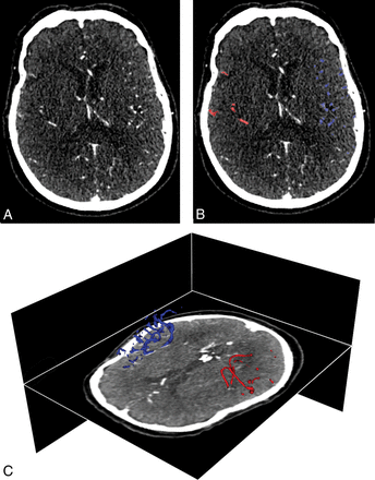 Fig 1.