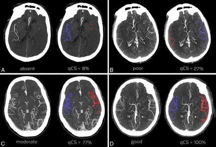 Fig 2.