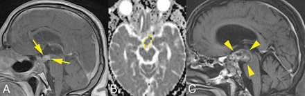 Fig 2.
