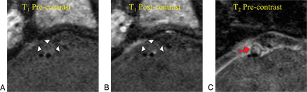 Fig 2.
