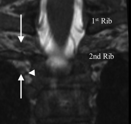 Fig 4.
