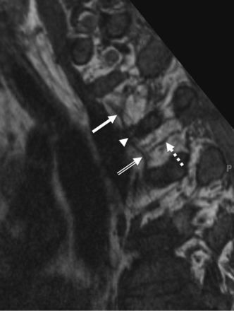Fig 5.