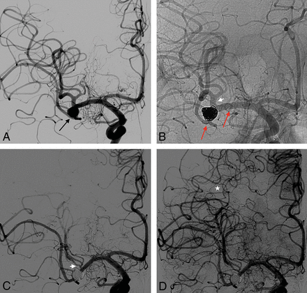 Fig 2.