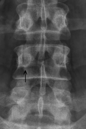 Fig 1.