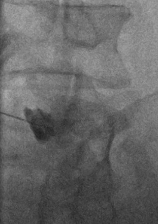 Fig 3.