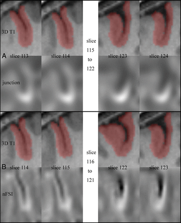 Fig 1.