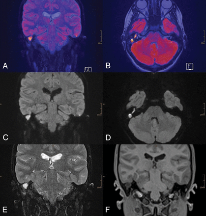 Fig 1.