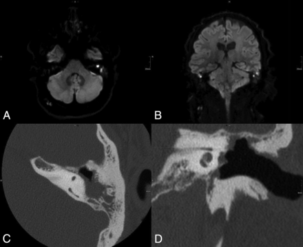 Fig 3.
