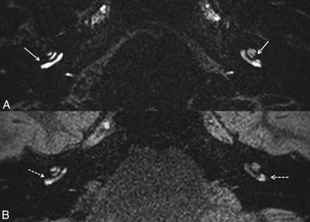 FIG 2.