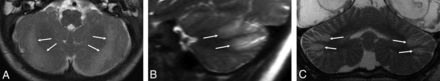 FIG 1.