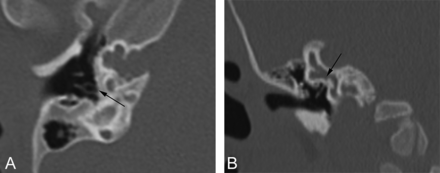 FIG 5.