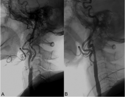 FIG 3.