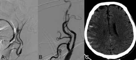 FIG 4.