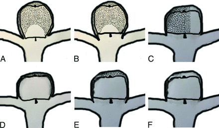 FIG 1.