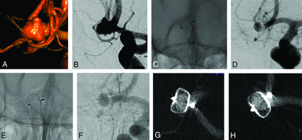 FIG 3.