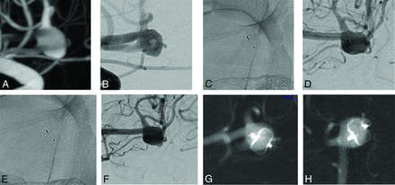 FIG 5.