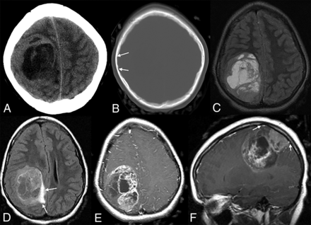 FIG 3.