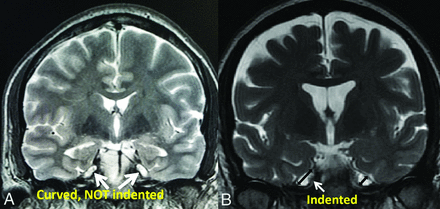 FIG 1.