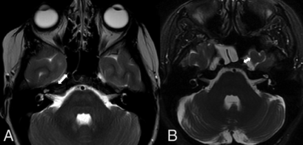 FIG 3.