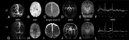FIG 4.