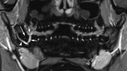 FIG 5.