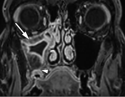 FIG 7.