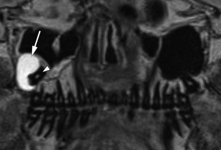 FIG 9.