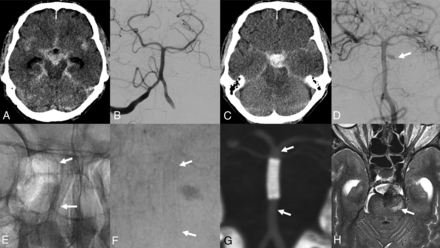 FIG 4.