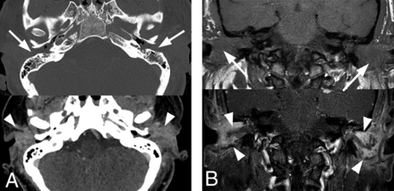 FIG 3.
