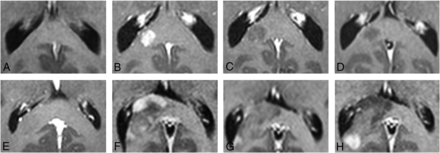 FIG 5.