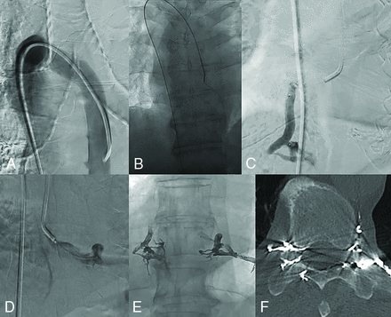 FIG 2.