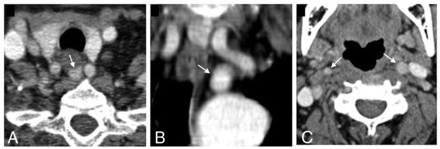 FIG 3.