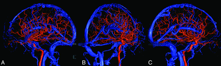 FIG 2.