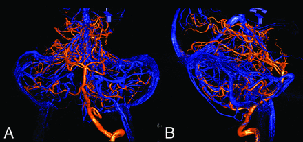 FIG 3.