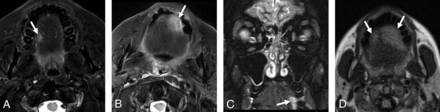 FIG 2.