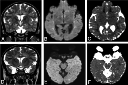 FIG 2.