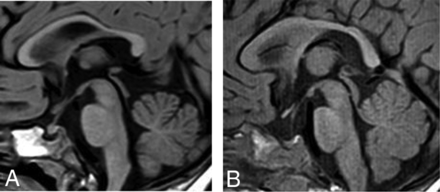 FIG 4.