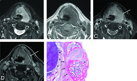 FIG 1.