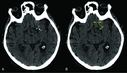 FIG 3.