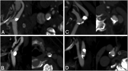 FIG 1.