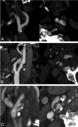 FIG 2.