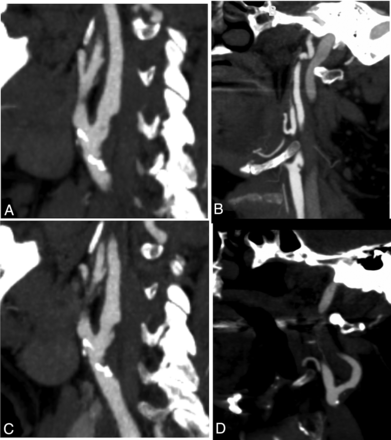FIG 3.