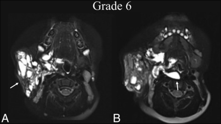 FIG 6.