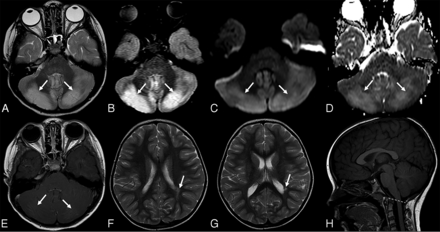 FIG 3.