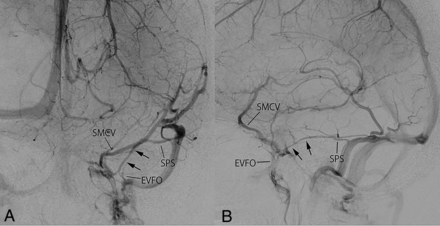 FIG 5.