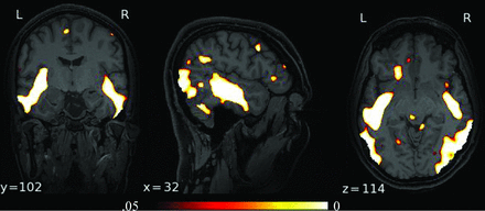 FIG 4.