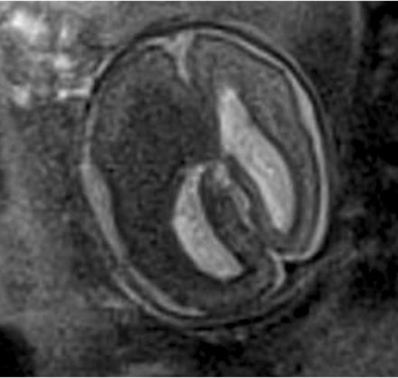 FIG 4.