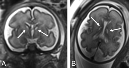 FIG 3.